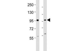 Western blot testing of EZH2 antibody at 1:2000 dilution.