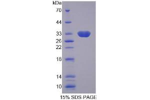 SDS-PAGE analysis of Human SLC25A13 Protein. (slc25a13 Protéine)