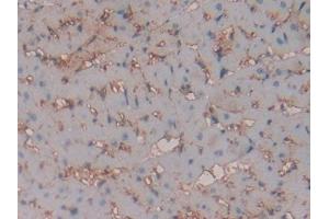 IHC-P analysis of Rat Heart Tissue, with DAB staining. (Caveolin-1 anticorps  (AA 2-105))