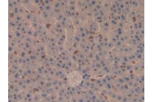 DAB staining on IHC-P; Samples: Rat Liver Tissue