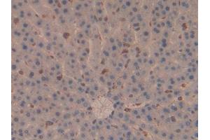 DAB staining on IHC-P; Samples: Rat Liver Tissue (Moesin anticorps  (AA 353-577))