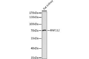 Western blot analysis of extracts of Rat kidney, using RNF112 antibody (ABIN7270054) at 1:1000 dilution. (RNF112 anticorps  (AA 200-500))