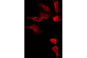 ABIN6274813 staining HepG2 by IF/ICC. (SLC25A6 anticorps  (Internal Region))