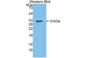 Western Blotting (WB) image for anti-Low Density Lipoprotein Receptor (LDLR) (AA 497-742) antibody (ABIN1868939) (LDLR anticorps  (AA 497-742))