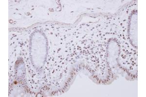 IHC-P Image RCL1 antibody [N1C3] detects RCL1 protein at nucleus on human normal colon by immunohistochemical analysis. (RCL1 anticorps)