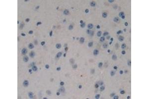 IHC-P analysis of Mouse Tissue, with DAB staining. (NPEPPS anticorps  (AA 584-755))