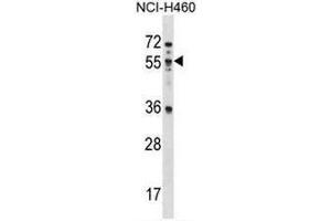 MEX3B Antibody (N-term) western blot analysis in NCI-H460 cell line lysates (35µg/lane). (MEX3B anticorps  (N-Term))