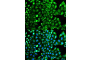 Immunofluorescence analysis of A549 cells using HLA-DRB1 antibody. (HLA-DRB1 anticorps)