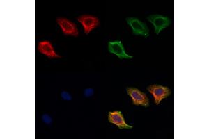 ABIN6256906 and ABIN6274857 staining Hela cells by IF/ICC. (Apolipoprotein L 2 anticorps  (C-Term))