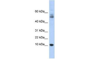 Myotrophin antibody used at 1 ug/ml to detect target protein. (MTPN anticorps  (Middle Region))