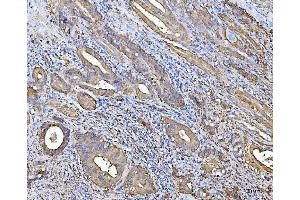 IHC analysis of ALDH1A1 using anti-ALDH1A1 antibody (ABIN7602128). (ALDH1A1 anticorps  (AA 6-342))