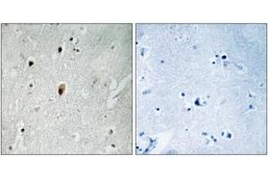 Immunohistochemistry analysis of paraffin-embedded human brain, using DNA-PK (Phospho-Thr2647) Antibody.