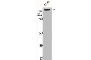 Western Blot analysis of A549 cells using GTBP Polyclonal Antibody (MSH6 anticorps  (Internal Region))