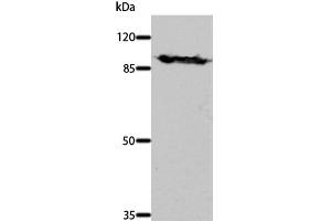 Western Blot analysis of Mouse brain tissue using DNM1 Polyclonal Antibody at dilution of 1:700 (Dynamin 1 anticorps)
