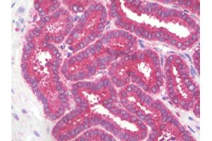 Anti-RAB5A / RAB5 antibody IHC staining of human prostate.