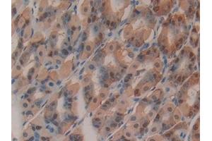 Detection of GSTo1 in Mouse Stomach Tissue using Polyclonal Antibody to Glutathione S Transferase Omega 1 (GSTo1)