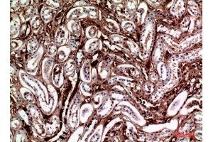 Immunohistochemistry (IHC) analysis of paraffin-embedded Human Kidney, antibody was diluted at 1:100. (M-CSF/CSF1 anticorps  (Internal Region))
