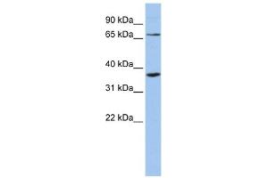 WB Suggested Anti-ZNF274 Antibody Titration:  0. (ZNF274 anticorps  (Middle Region))