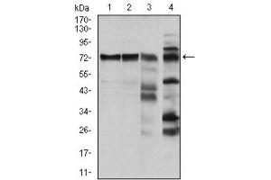 Western Blotting (WB) image for anti-V-Raf-1 Murine Leukemia Viral Oncogene Homolog 1 (RAF1) antibody (ABIN1844891) (RAF1 anticorps)