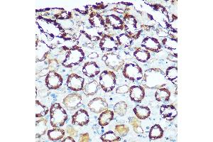 Immunohistochemistry of paraffin-embedded rat kidney using H Rabbit pAb (ABIN6131125, ABIN6137333, ABIN6137334 and ABIN6220624) at dilution of 1:100 (40x lens).