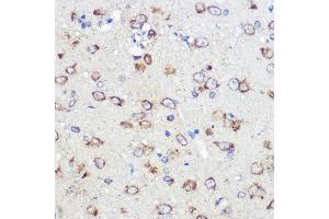 Immunohistochemistry of paraffin-embedded rat brain using LRRC59 Rabbit pAb  at dilution of 1:100 (40x lens).
