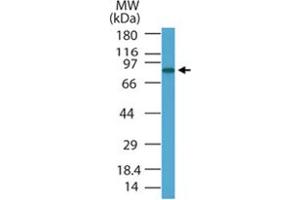 Western blot analysis of PRDM5 in HL-60 cell lysate using PRDM5 polyclonal antibody  at 1 ug/mL . (PRDM5 anticorps  (AA 100-200))