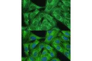 Immunofluorescence analysis of U2OS cells using NF-kB p65/RelA antibody (ABIN3016234, ABIN3016235, ABIN3016236 and ABIN6219643) at dilution of 1:100.