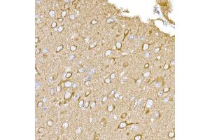 Immunohistochemistry of paraffin-embedded rat brain using M Rabbit pAb (ABIN3021414, ABIN3021415, ABIN3021416 and ABIN6215021) at dilution of 1:500 (40x lens).