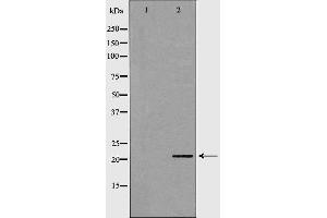 Western blot analysis of stomach  lysate using CSRP1 antibody. (CSRP1 anticorps  (Internal Region))