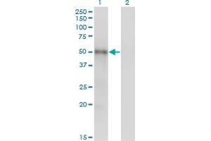 Western Blot analysis of MKNK1 expression in transfected 293T cell line by MKNK1 monoclonal antibody (M06), clone 3E1.