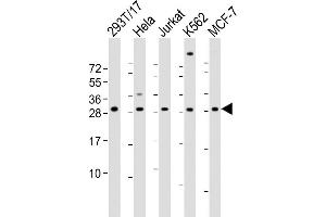 All lanes : Anti-RPL13 Antibody (Center) at 1:2000 dilution Lane 1: 293T/17 whole cell lysate Lane 2: Hela whole cell lysate Lane 3: Jurkat whole cell lysate Lane 4: K562 whole cell lysate Lane 5: MCF-7 whole cell lysate Lysates/proteins at 20 μg per lane. (RPL13 anticorps  (AA 49-82))