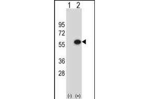 Western blot analysis of ERGIC3 (arrow) using rabbit polyclonal ERGIC3 Antibody (N-term) (ABIN653165 and ABIN2842731).
