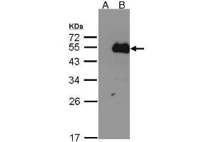 WB Image Western Blot analysis of NFIB expression in transfected 293T cell line by NFIB polyclonal antibody. (NFIB anticorps)