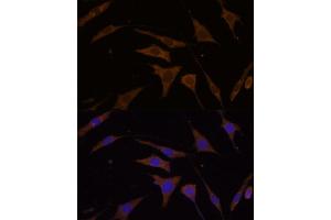 Immunofluorescence analysis of L929 cells using RPL7 Polyclonal Antibody (ABIN6128656, ABIN6147148, ABIN6147149 and ABIN6221631) at dilution of 1:100 (40x lens). (RPL7 anticorps  (AA 1-248))