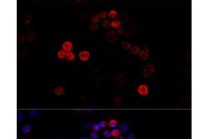Immunofluorescence analysis of HeLa cells using FLNA Polyclonal Antibody at dilution of 1:100 (40x lens). (Filamin A anticorps)