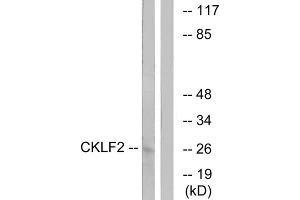 Western blot analysis of extracts from K562 cells, using CKLF2 antibody. (CKLF anticorps  (C-Term))