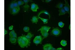Immunofluorescence staining of MCF-7 cells with ABIN7154884 at 1:100, counter-stained with DAPI.