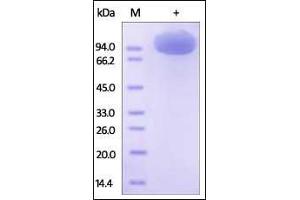 Human M-CSF R, Fc Tag on SDS-PAGE under reducing (R) condition.