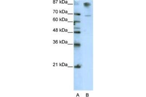 Western Blotting (WB) image for anti-HKR1, GLI-Kruppel Zinc Finger Family Member (HKR1) antibody (ABIN2462014) (HKR1 anticorps)