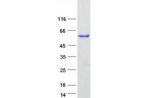 Validation with Western Blot