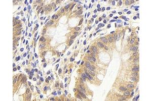 Immunohistochemistry analysis of paraffin-embedded human colon using CDC25A Polyclonal Antibody at dilution of 1:1000. (CDC25A anticorps)