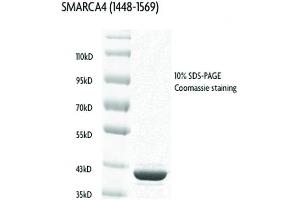 Recombinant SMARCA4 / BRG1 (1448-1569), GST-tag protein gel. (SMARCA4 Protein (AA 1448-1569) (GST tag))