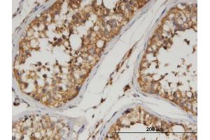 Immunoperoxidase of monoclonal antibody to ANGPTL3 on formalin-fixed paraffin-embedded human testis.