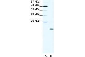 WB Suggested Anti-ID4 Antibody Titration:  1. (ID4 anticorps  (N-Term))