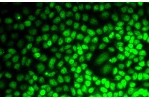 Immunofluorescence analysis of MCF7 cells using CCNE2 Polyclonal Antibody (Cyclin E2 anticorps)