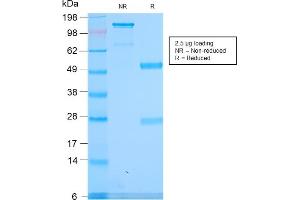 SDS-PAGE Analysis Purified Spectrin alpha 1 Rabbit Recombinant Monoclonal (SPTA1/2939R).