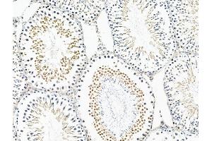 ABIN6263956 and ABIN6268907 at 1/100 staining Rat testis tissue by IHC-P. (p300 anticorps  (N-Term))