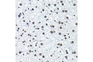 Immunohistochemistry of paraffin-embedded mouse liver using SNRP Rabbit pAb (2161) at dilution of 1:200 (40x lens). (SNRPA1 anticorps  (AA 1-220))