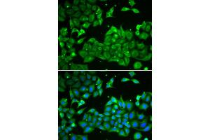 Immunofluorescence analysis of HeLa cells using ALDH3A1 antibody. (ALDH3A1 anticorps)