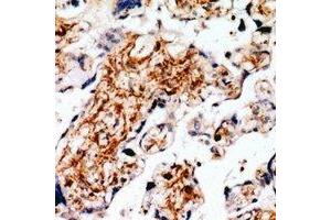 Immunohistochemical analysis of RLK staining in human placenta formalin fixed paraffin embedded tissue section.